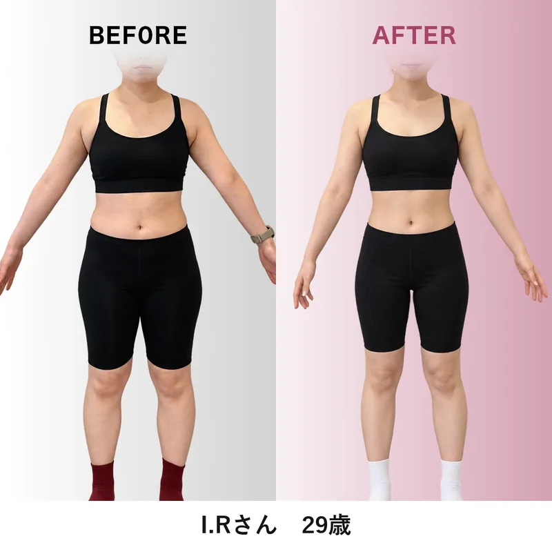 I.Rさんのビフォーアフター