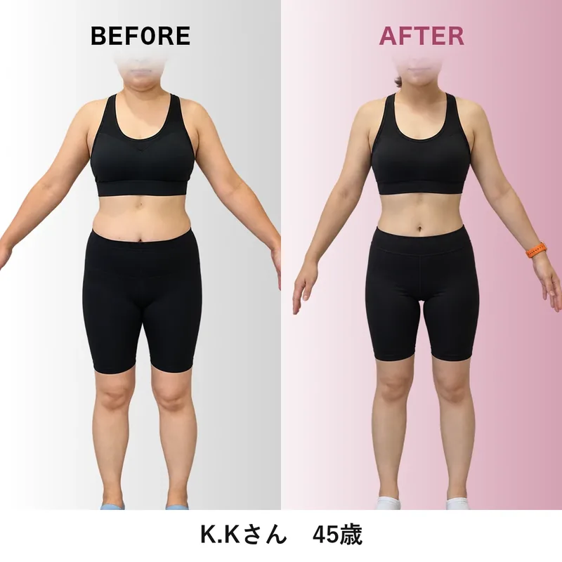 K.Kさんのビフォーアフター