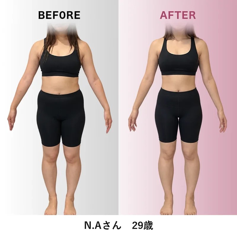 N.Aさんのビフォーアフター